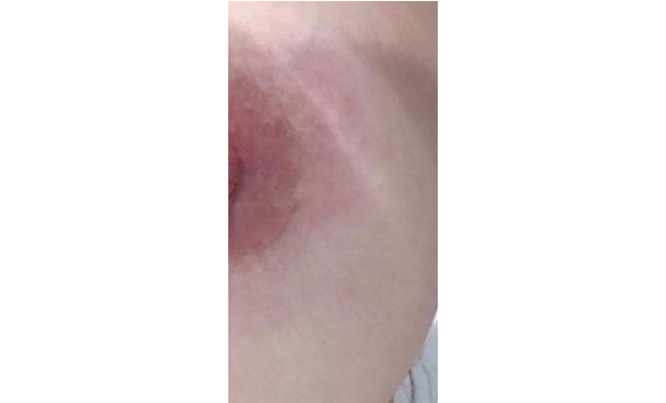 ローマピンク ギャラリー