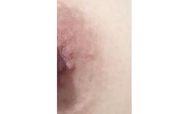 ローマピンク ギャラリー