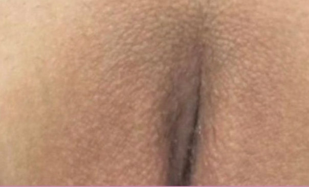 ローマピンク ギャラリー