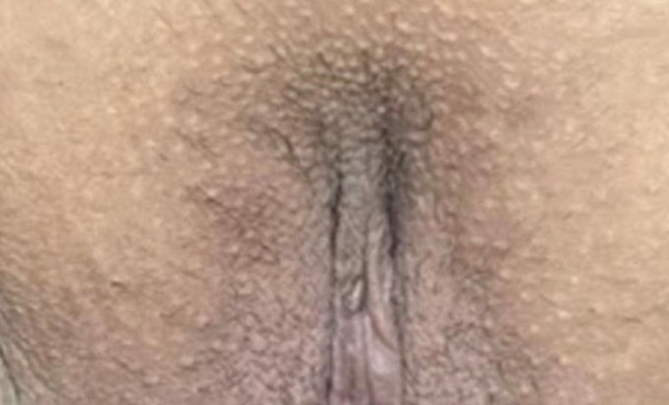 ローマピンク ギャラリー