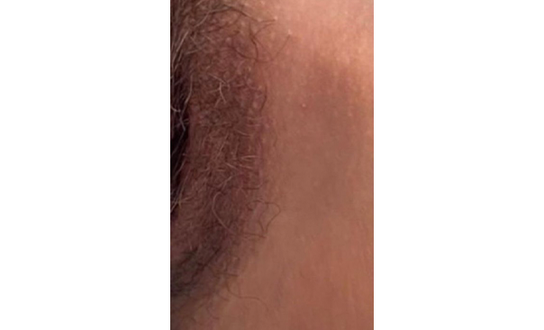 ローマピンク ギャラリー