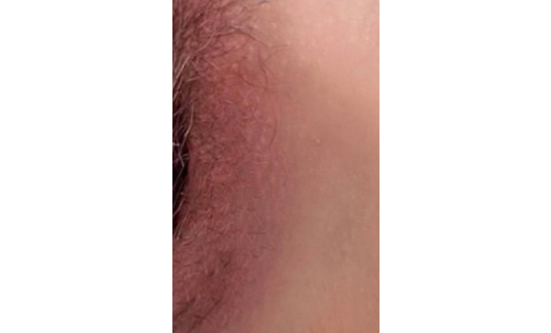 ローマピンク ギャラリー