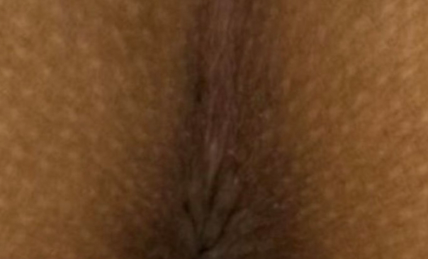 ローマピンク ギャラリー