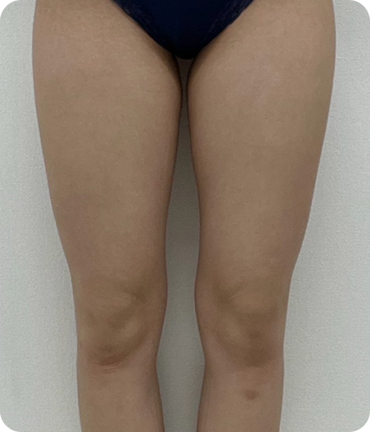 レモンボトル ギャラリー