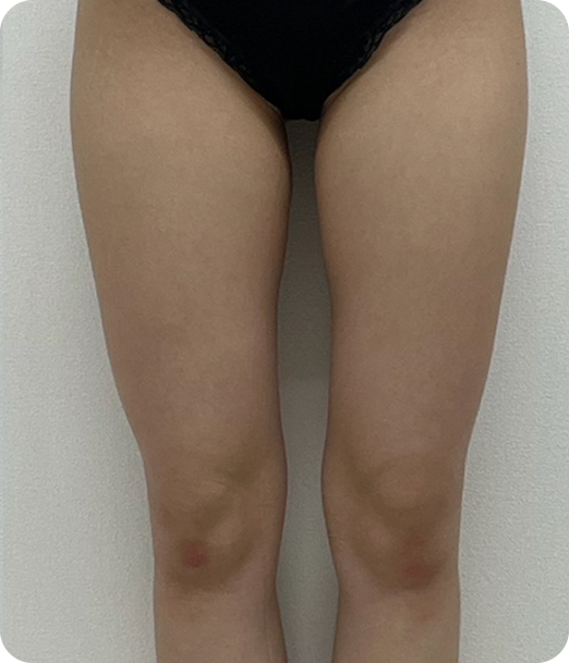 レモンボトル ギャラリー